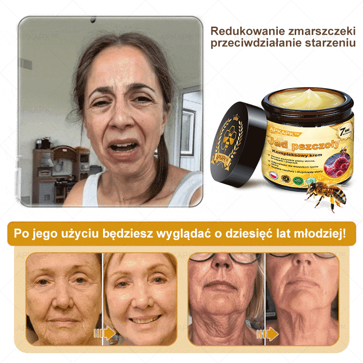 ΑPΚΑPK™ Jad Pszczoły Kompleksowy Krem🥇pomaga w leczeniu problemów skórnych, takich jak: zmarszczki, blizny, plamy pigmentacyjne, rozstępy, trądzik, łuszczyca, egzema, zmiany skórne, podrażnienia, stany zapalne i inne problemy skórne🔥