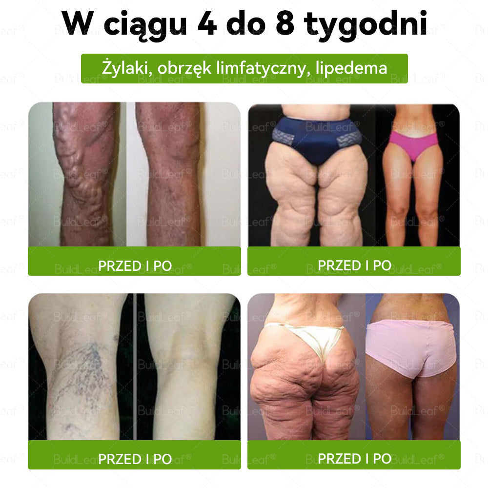 🎁🎁OSTATNIA SZANSA! Zostało tylko 5 sztuk! Oferujemy ogromną zniżkę 50%! 🌸Wyprodukowano i wysłano z Polski 🇵🇱 BuildLeaf® Tyrzepatyd GLP-1 Krople odchudzające i wspomagające zdrowie🔥🔥 Nie przegap, kolejna taka okazja dopiero w przyszłym roku!