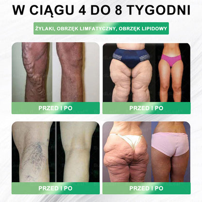 🎁 Zostało tylko 5 sztuk! Oferujemy dodatkową zniżkę 50%! Zdobądź formę i zdrowie. Nie czekaj, stracisz okazję, aż do przyszłego roku.